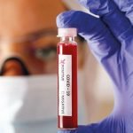 4 Temmuz Corona Virüs Türkiye tablosunda son durum: Türkiye ve dünyada koronavirüs vaka ve ölüm sayısı Covid 19 haritası 7 4 temmuz corona virus turkiye tablosunda son durum turkiye ve dunyada koronavirus vaka ve olum sayisi covid 19 haritasi 6